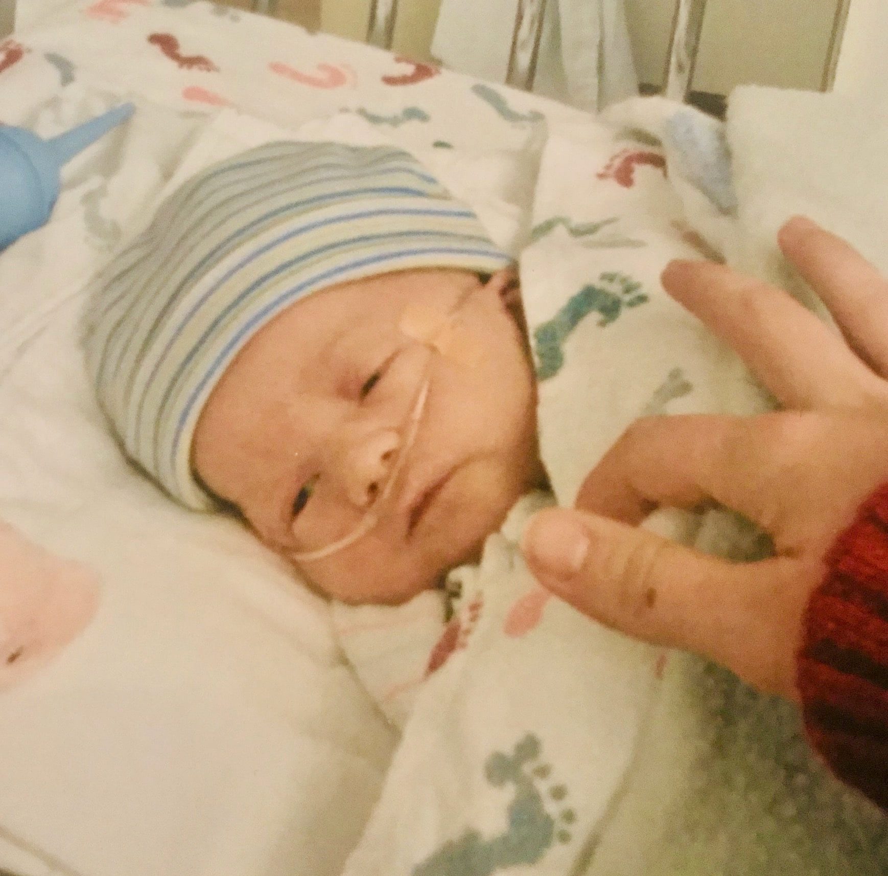 close up of a baby's face lying in his hospital bed