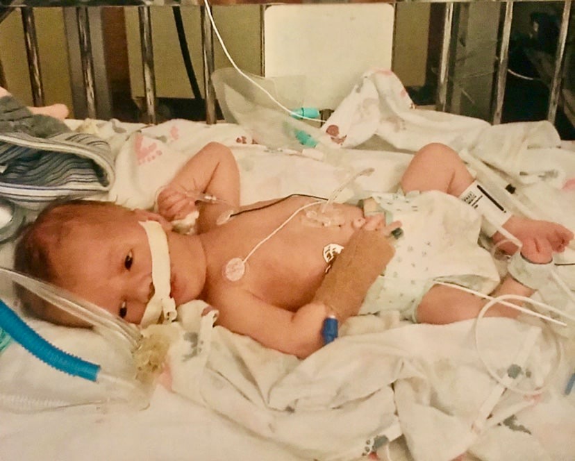 baby laying in a hospital bed